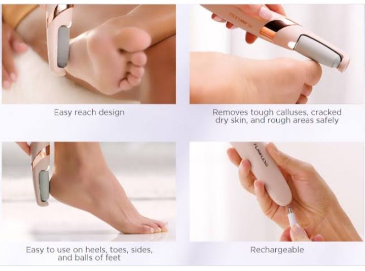 Portable Callus Remover