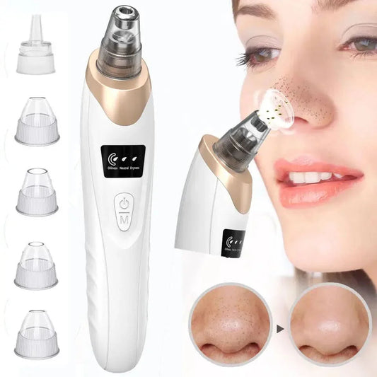 blackhead-remover